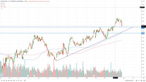 philips share price forecast.